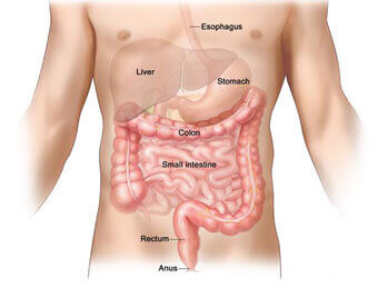 colorectal-surgery-man